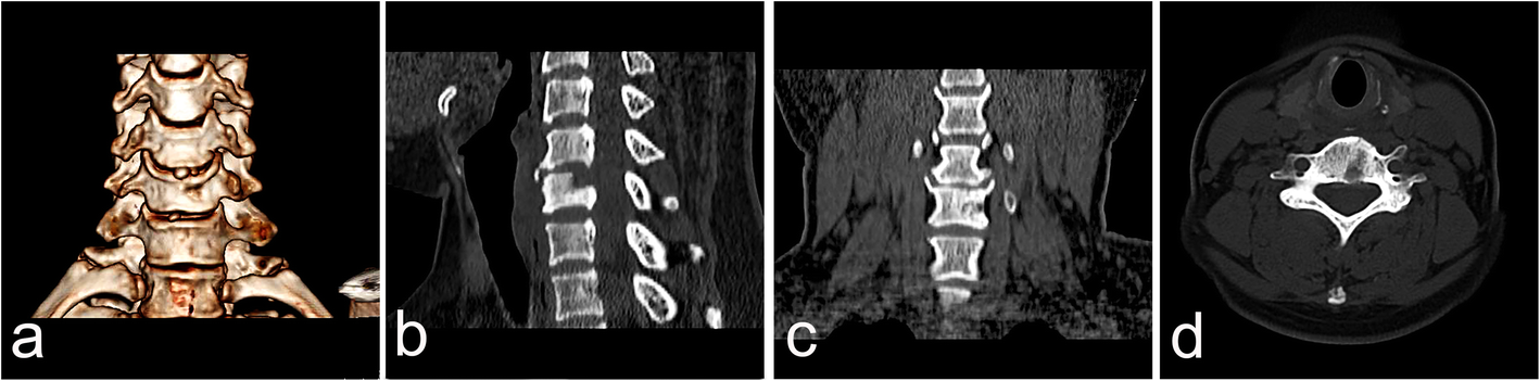 Fig. 6