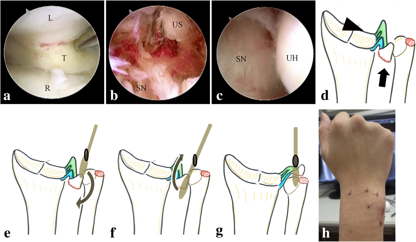 Fig. 2