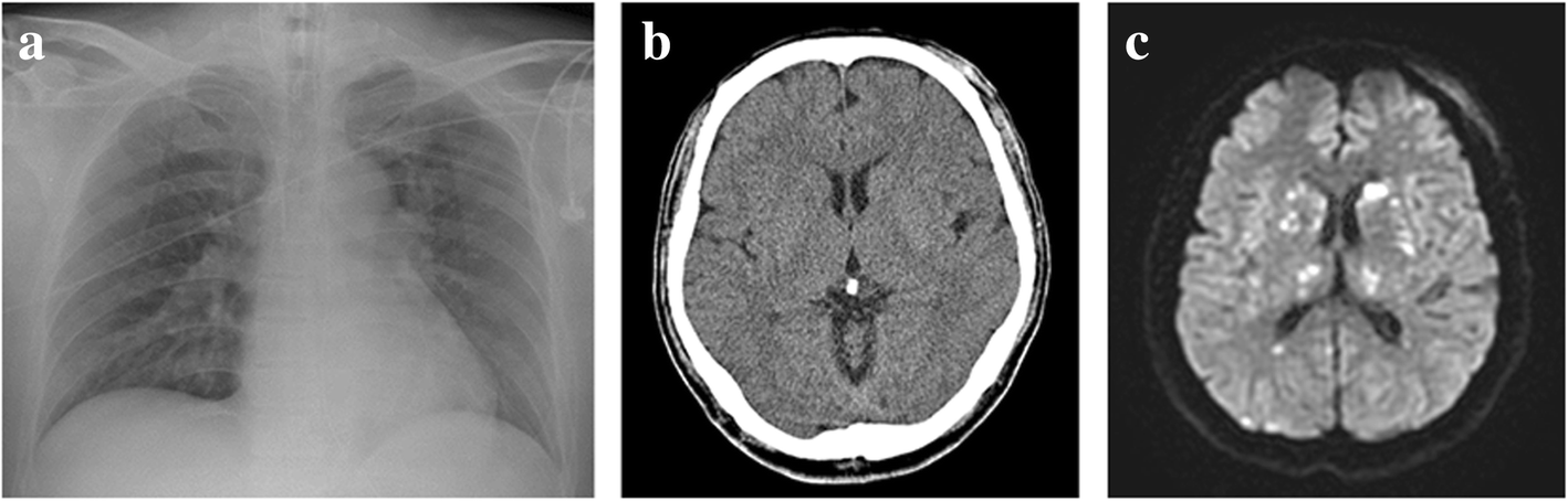 Fig. 2