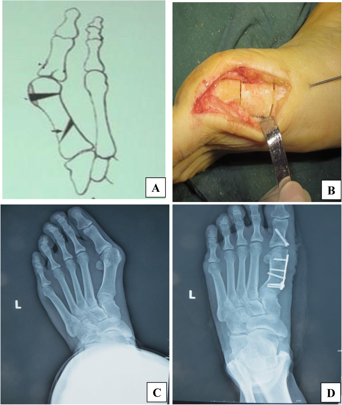 Fig. 2