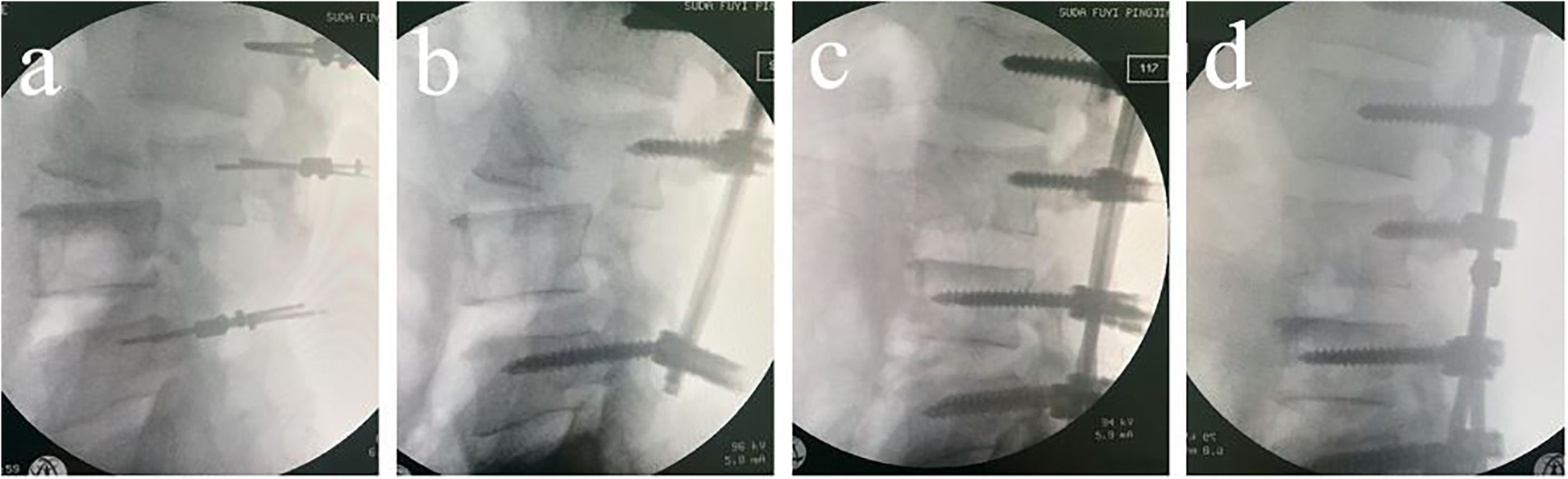 Fig. 2