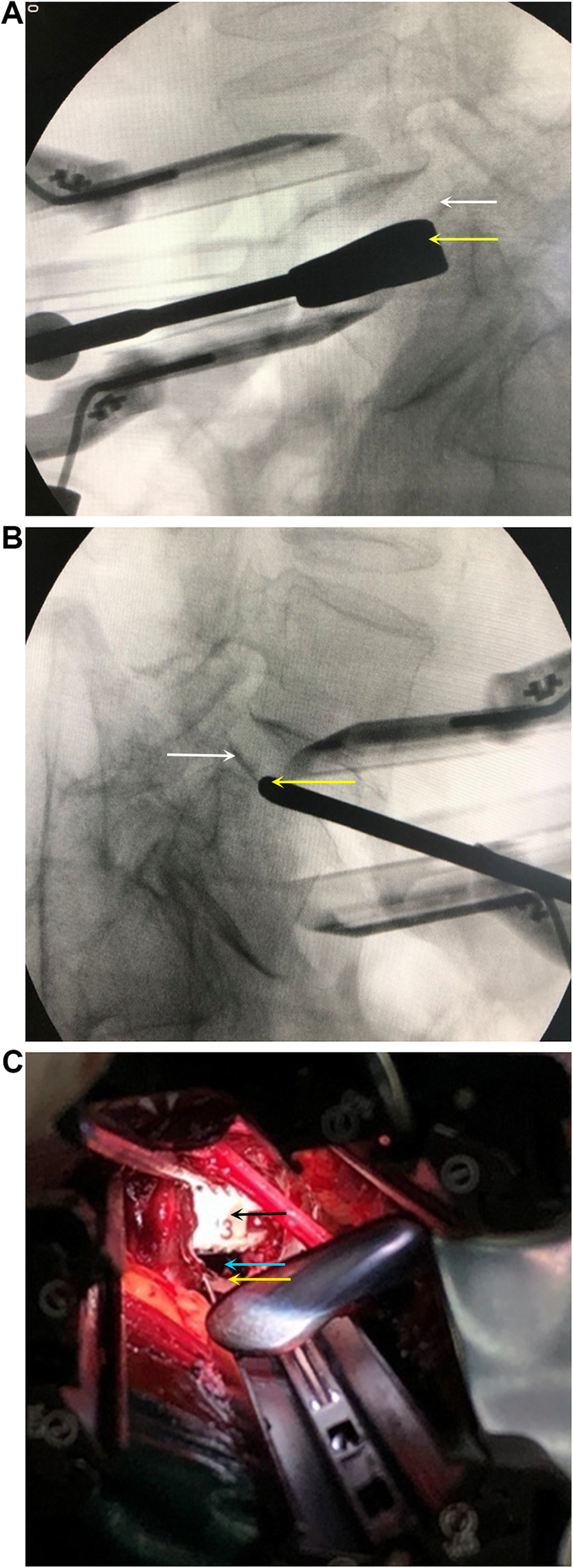 Fig. 4