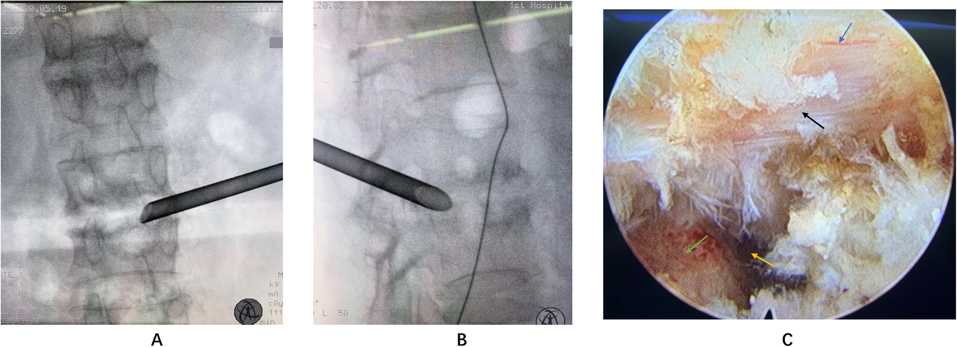 Fig. 4