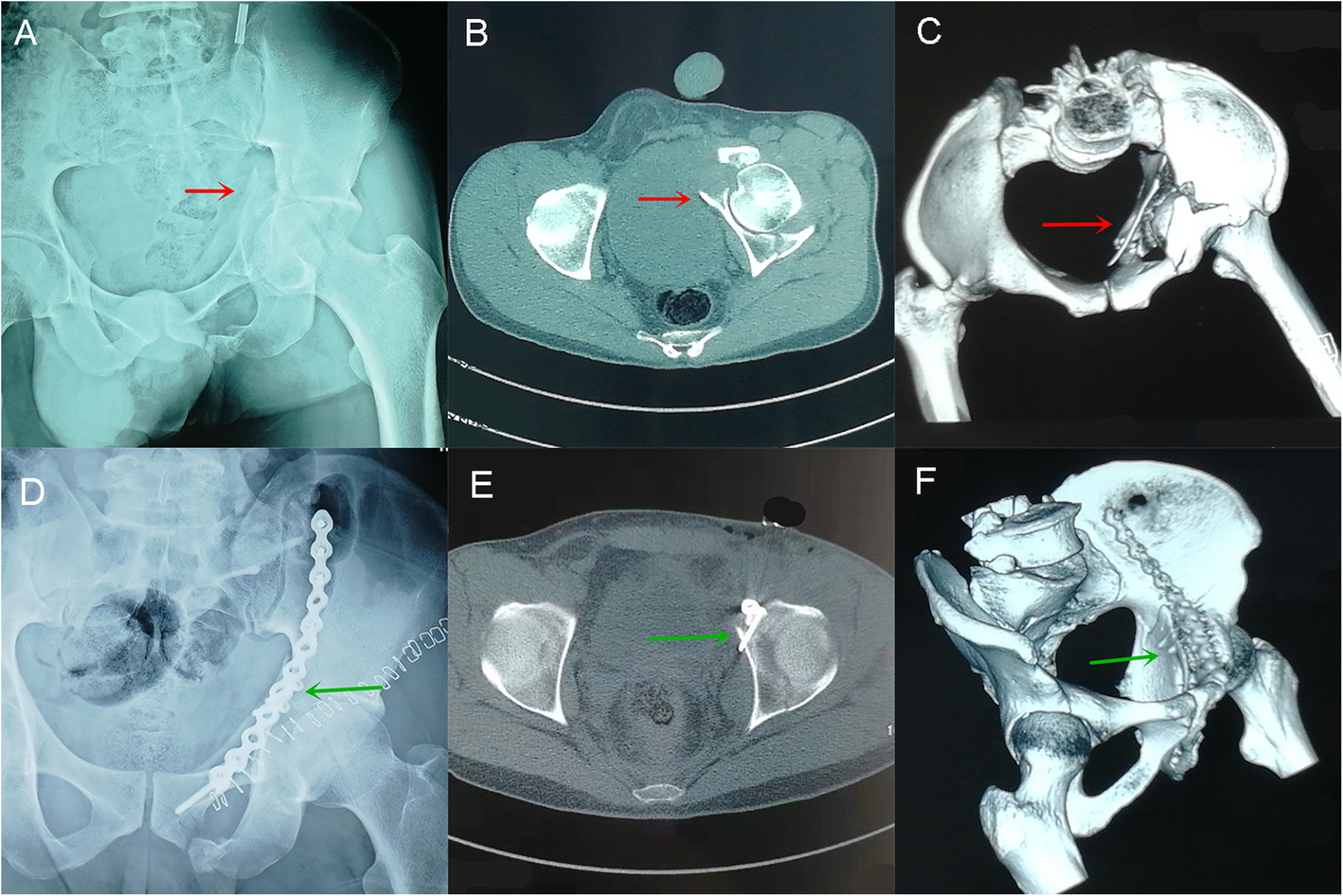 Fig. 3