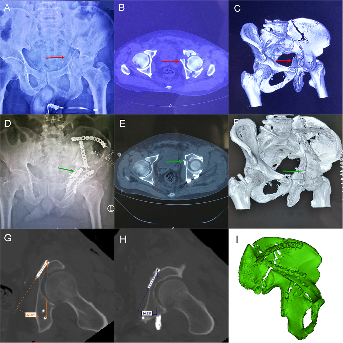 Fig. 4