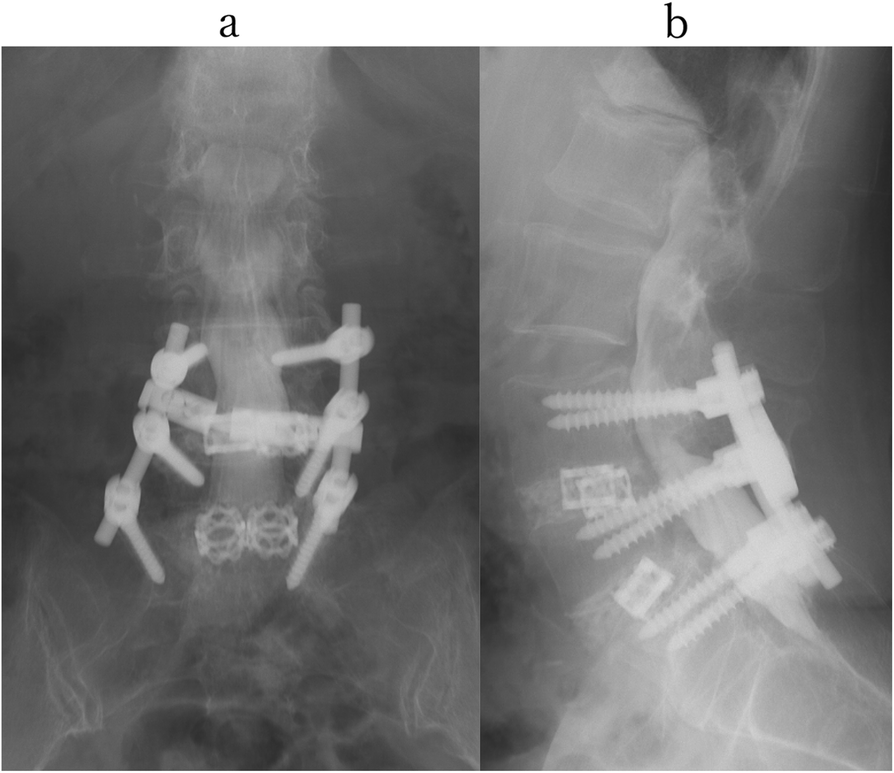 Fig. 2