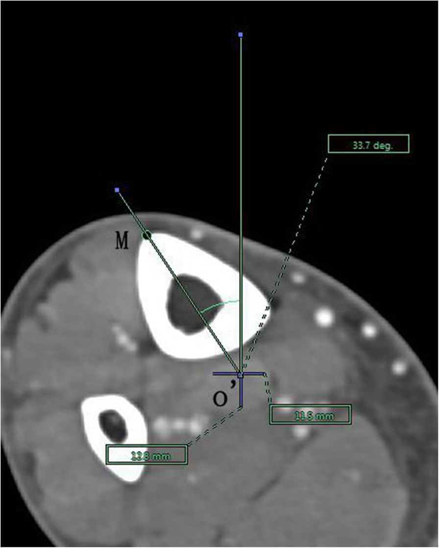 Fig. 10