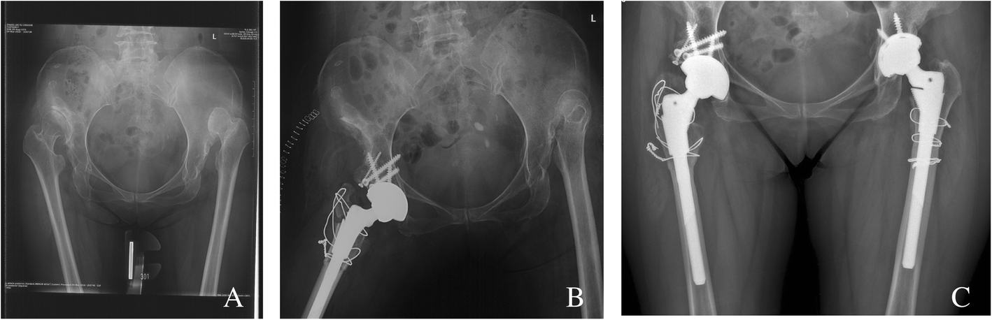 Fig. 4