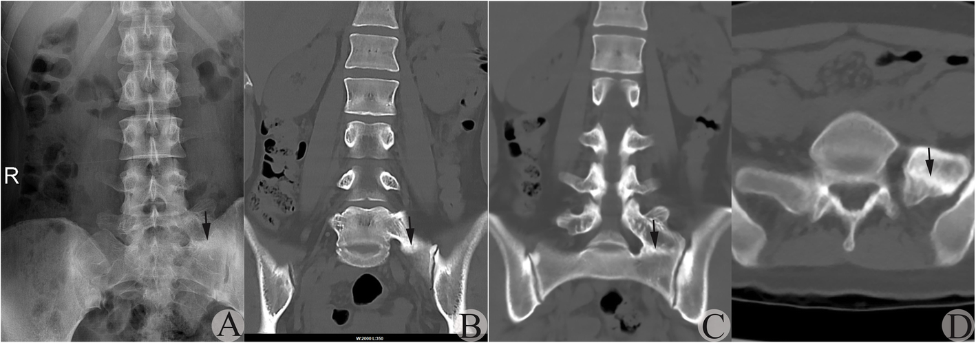 Fig. 4