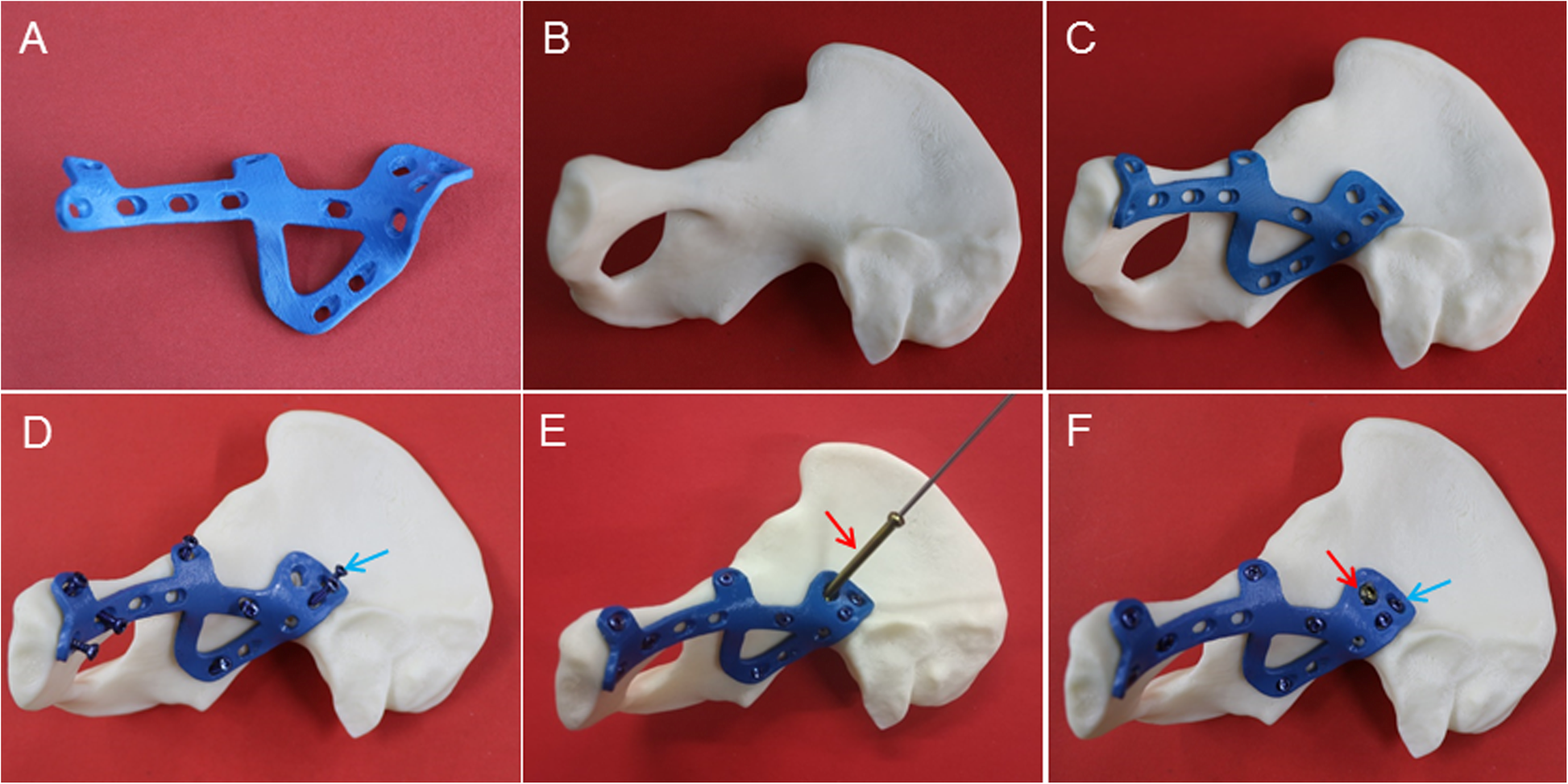 Fig. 2