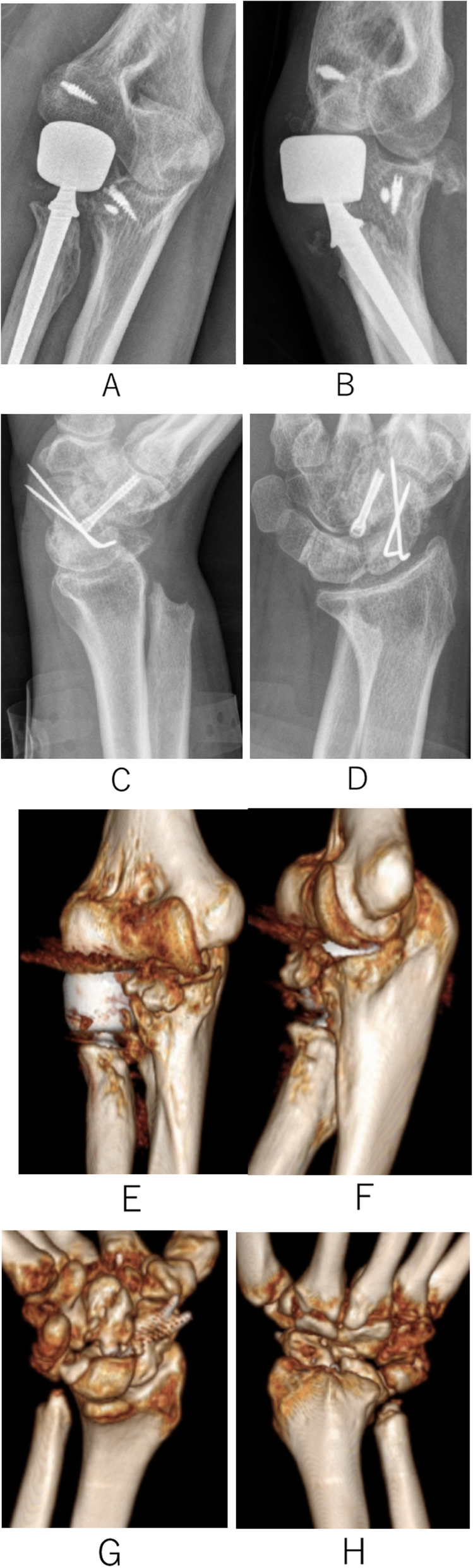 Fig. 4