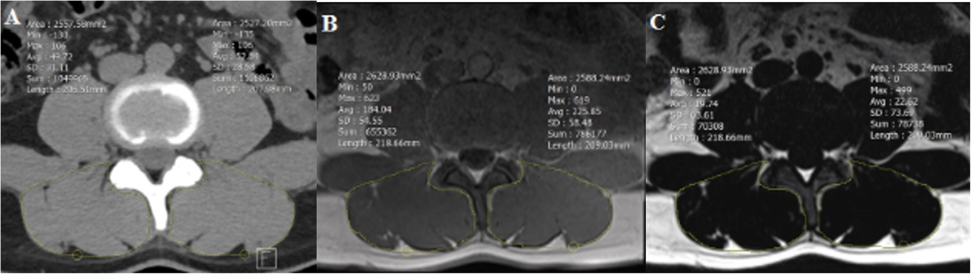 Fig. 2