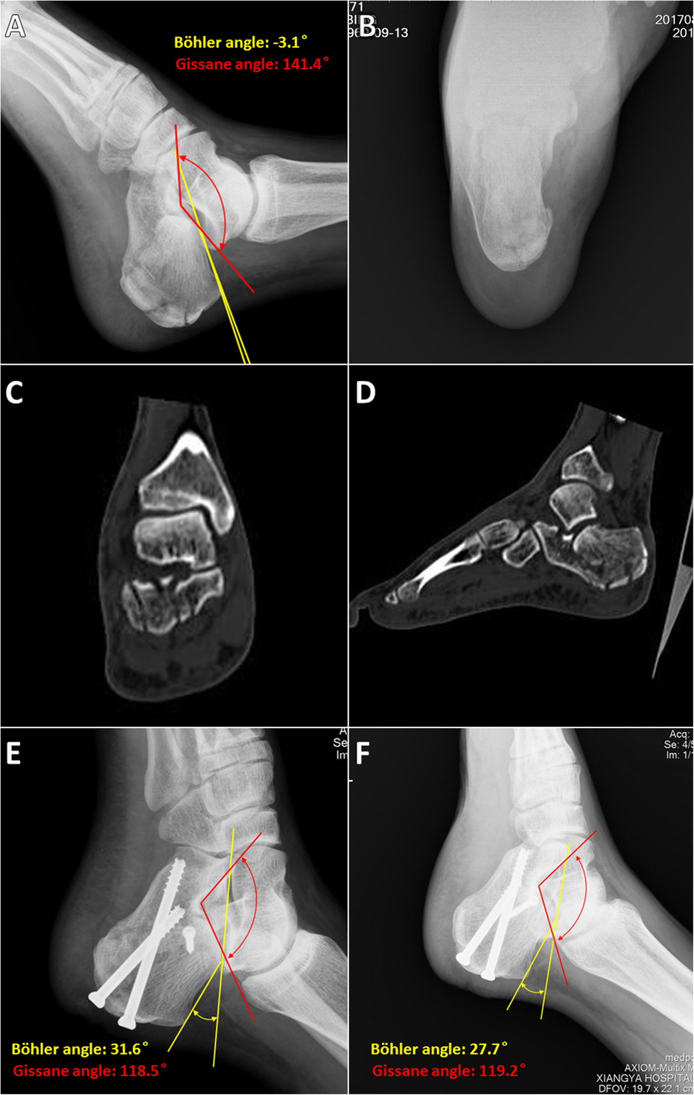 Fig. 4