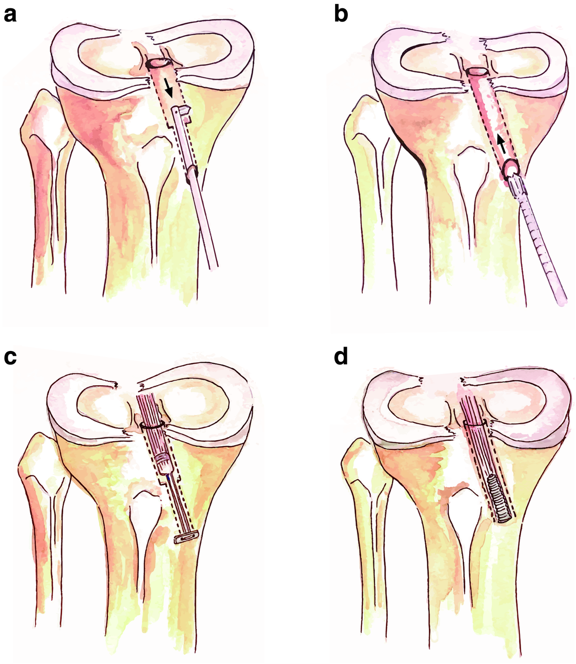 Fig. 1