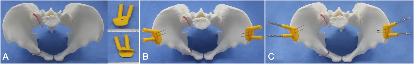 Fig. 2