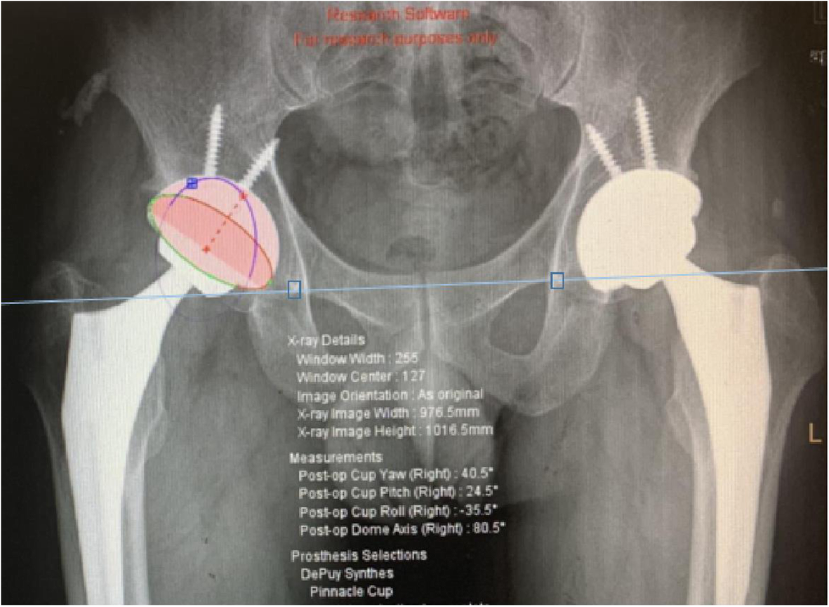 Fig. 2