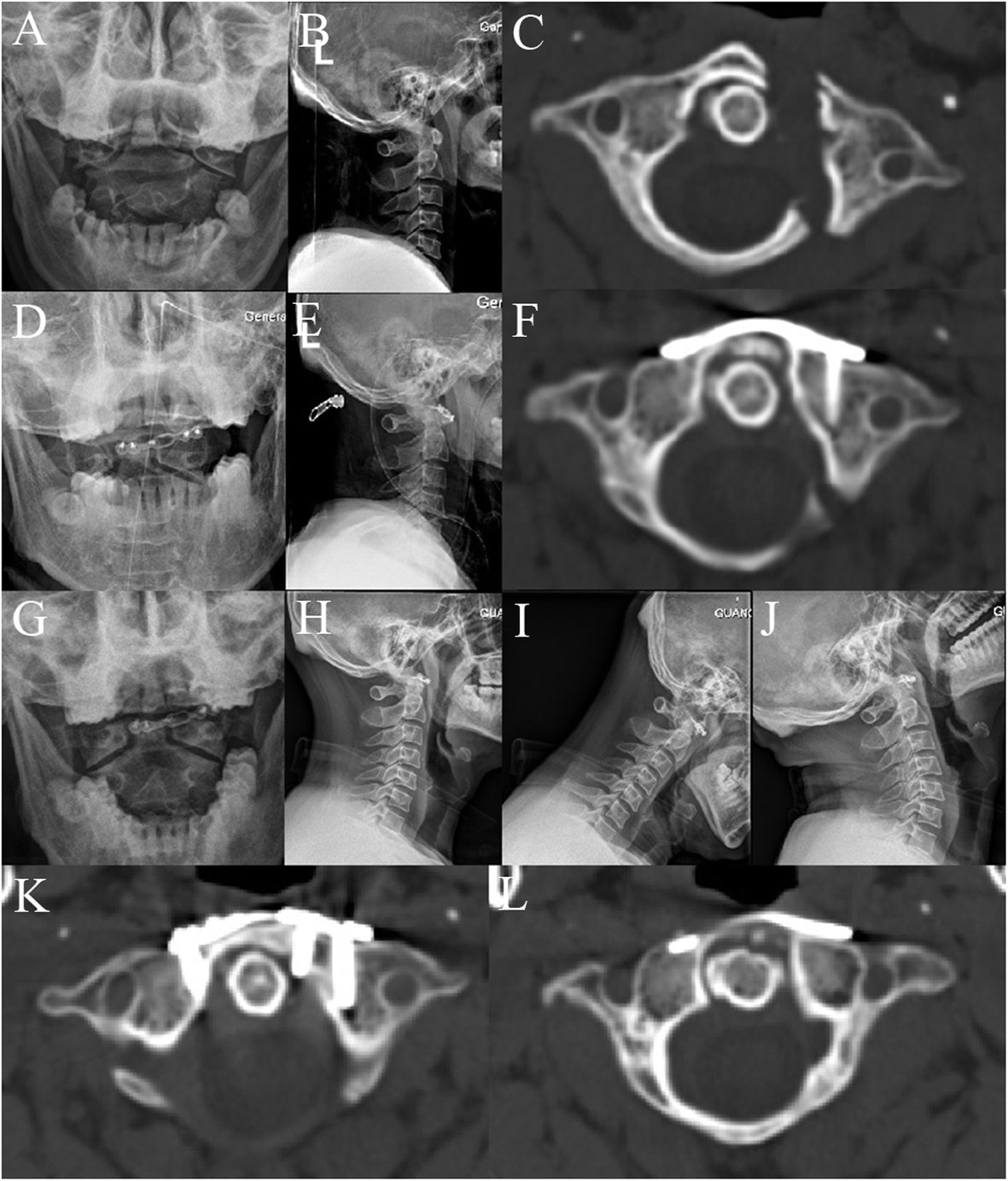 Fig.4