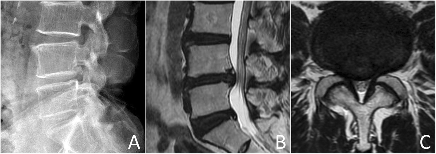 Fig. 1