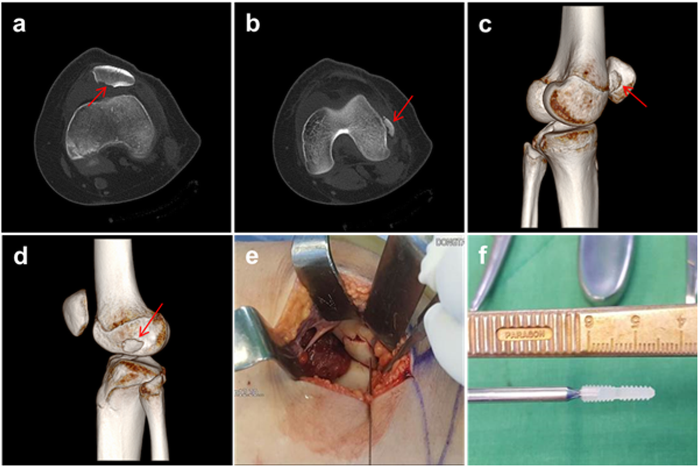 Fig. 4