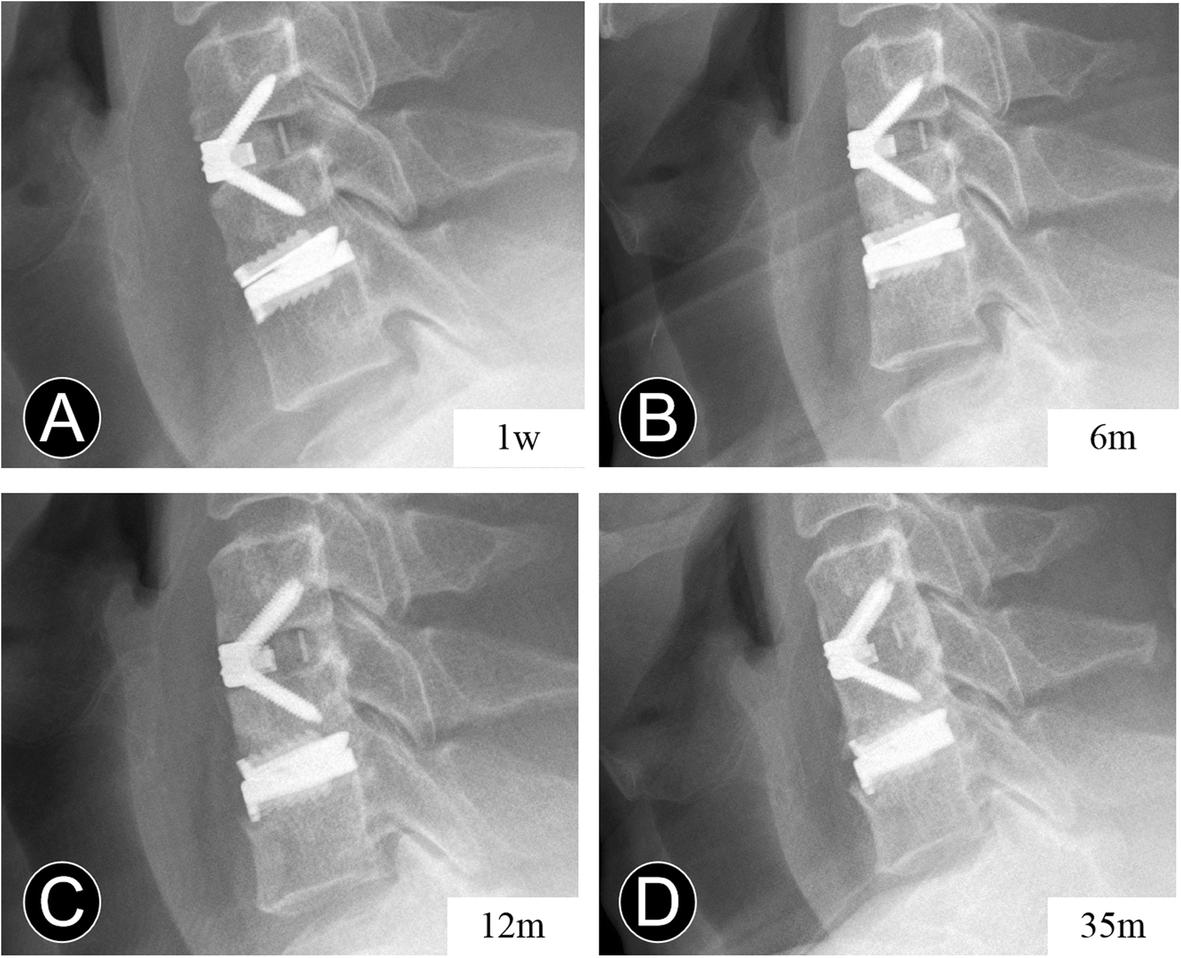 Fig. 4