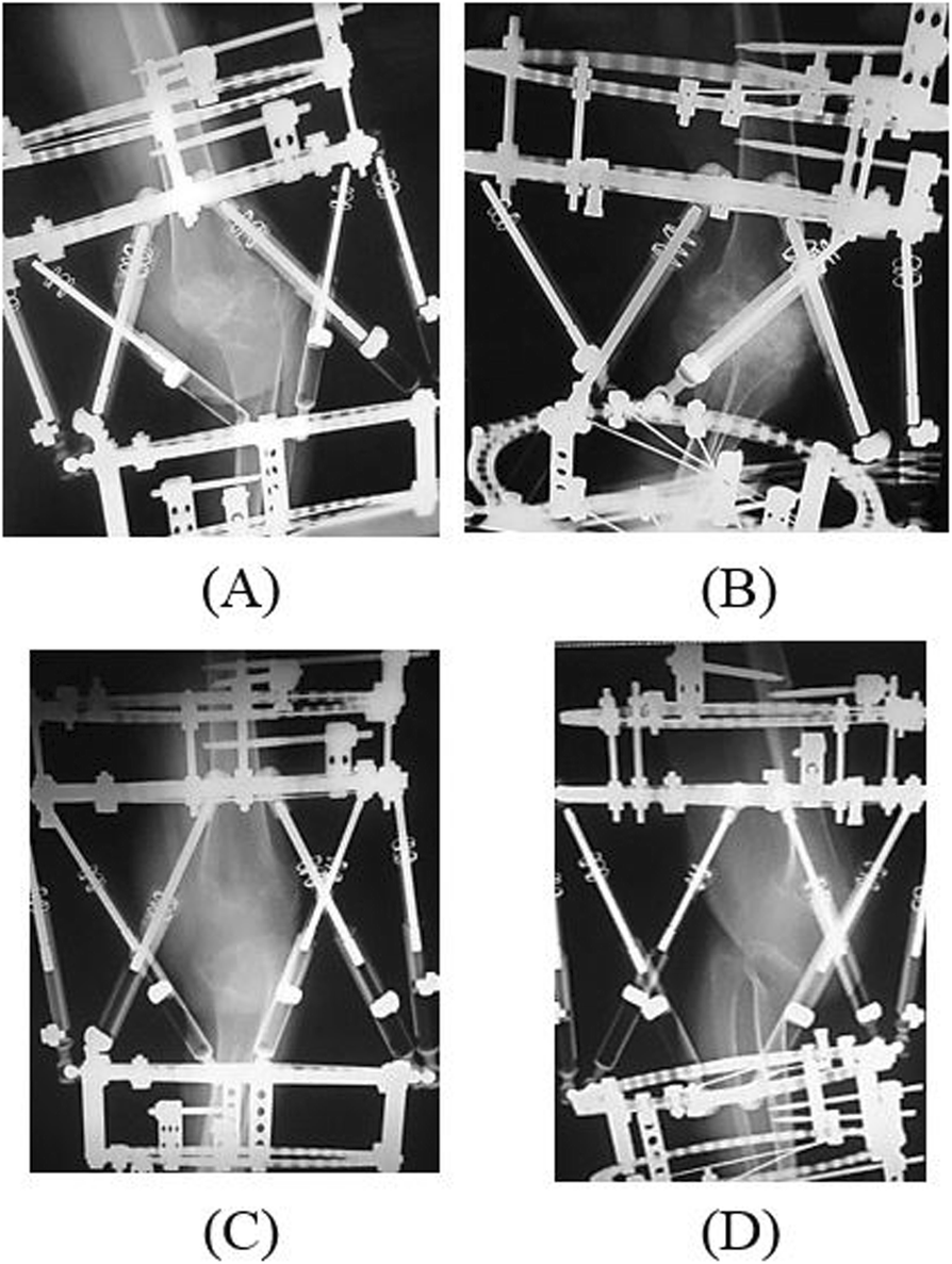 Fig. 5