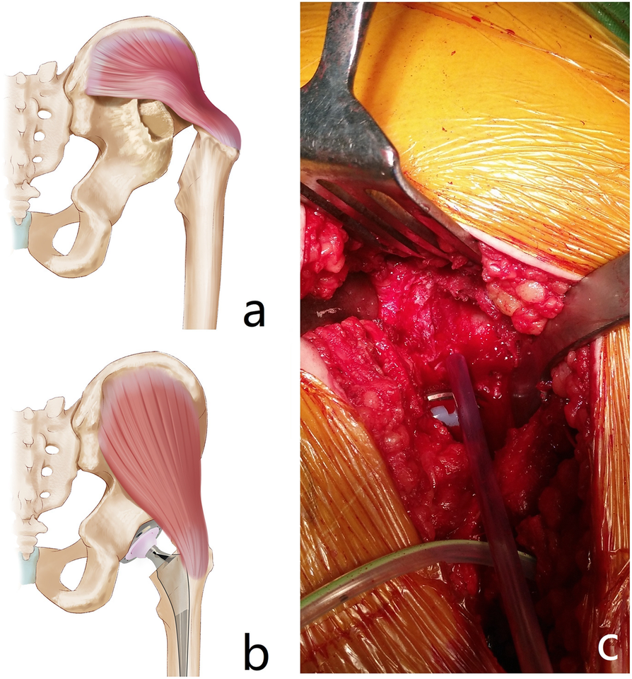 Fig. 5