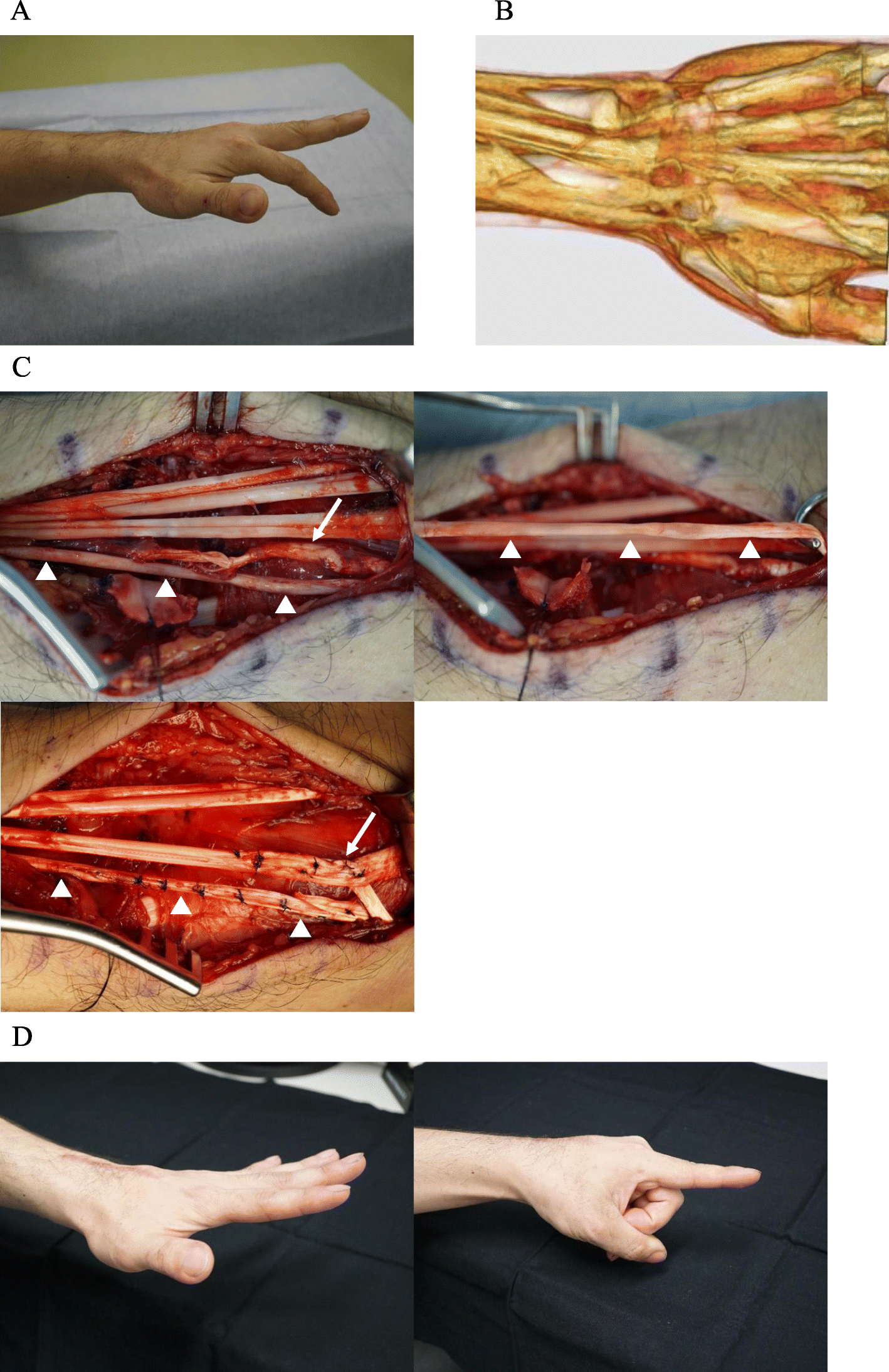 Fig. 2