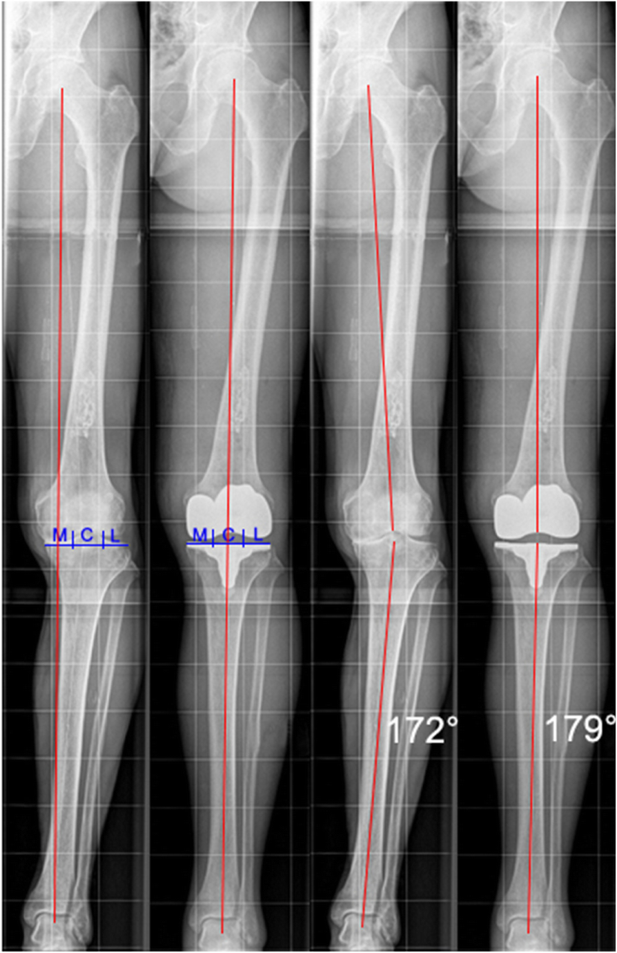 Fig. 4