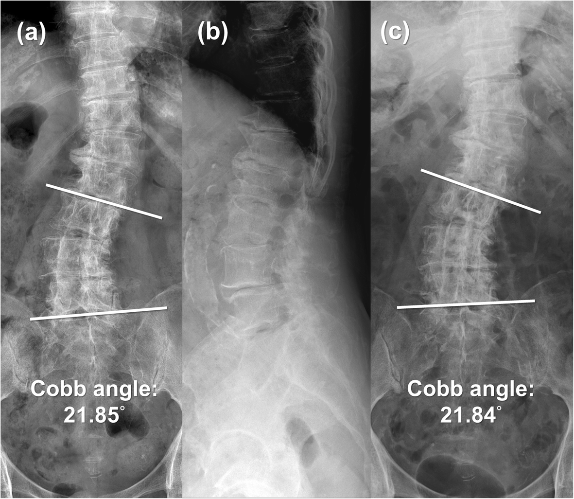 Fig. 1