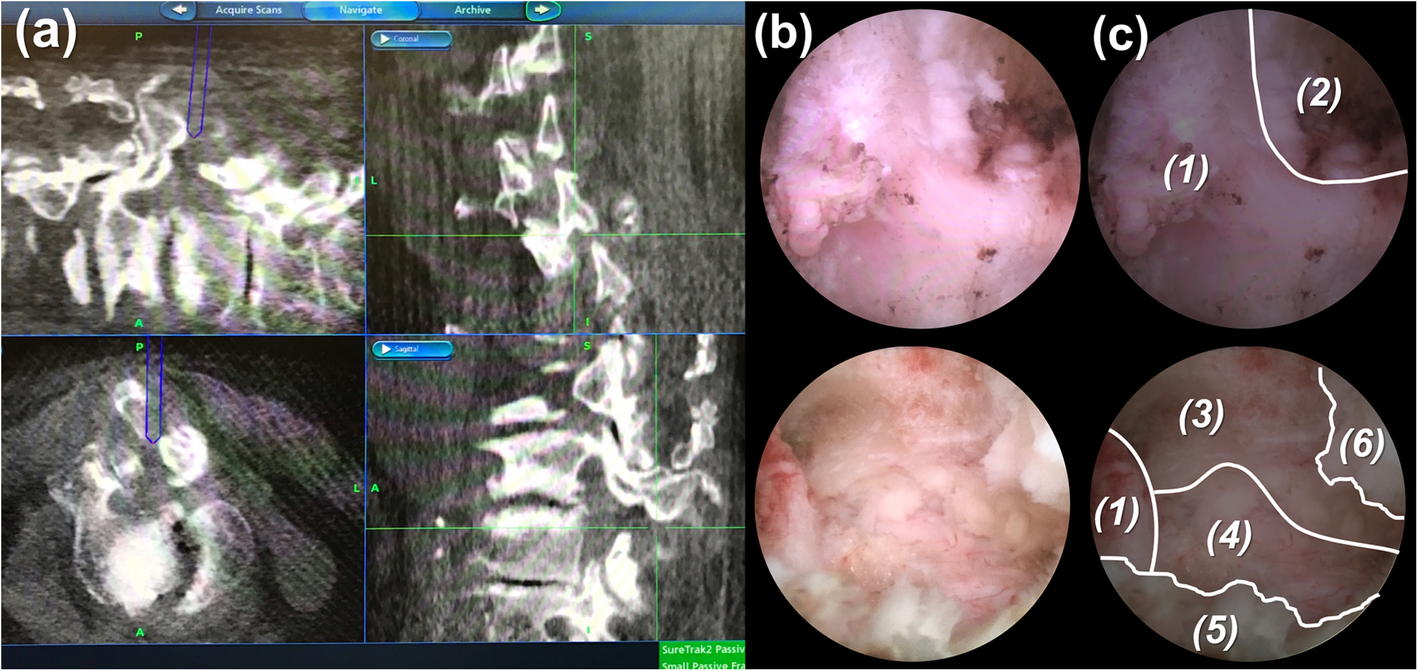 Fig. 6