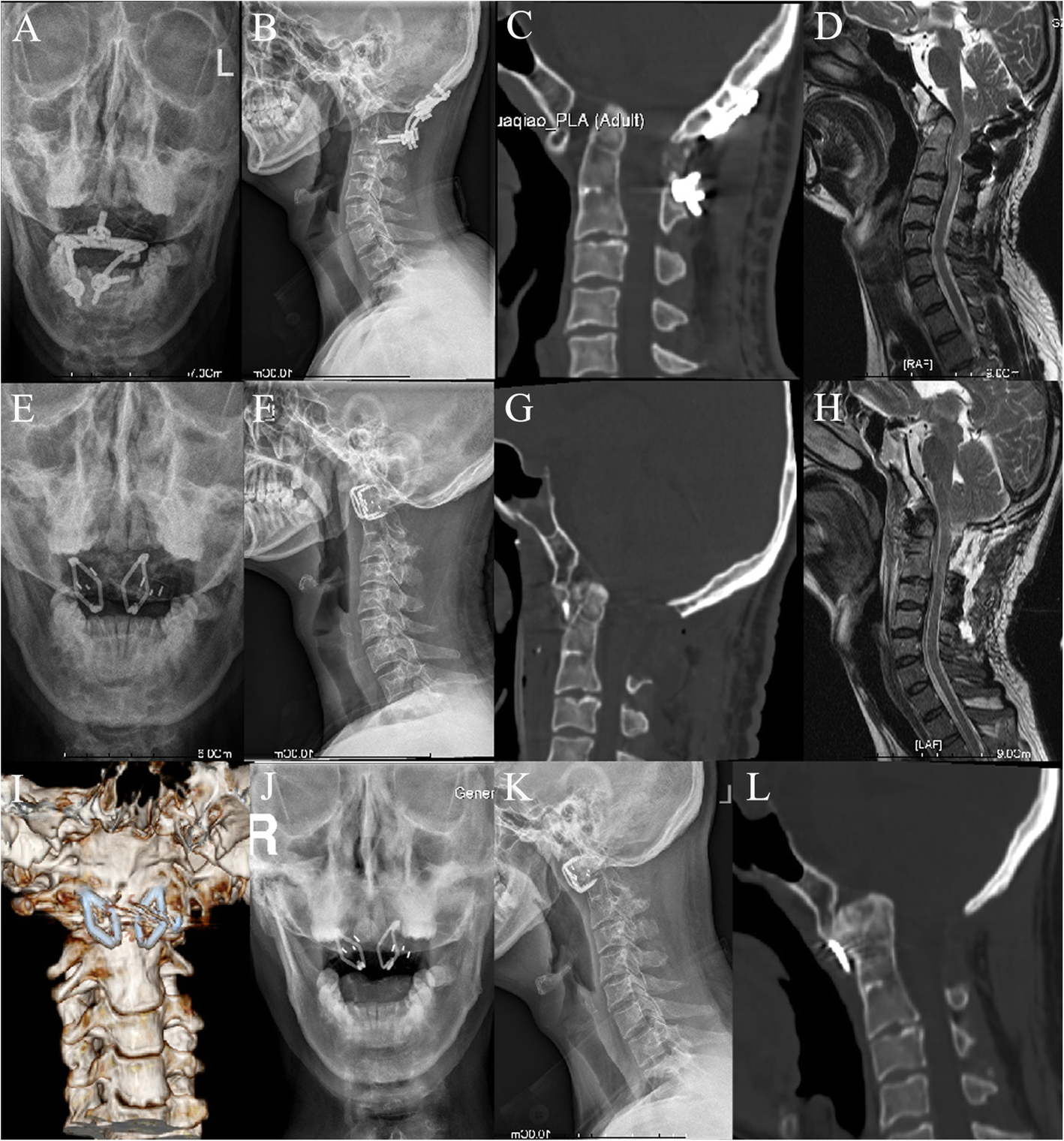 Fig. 3