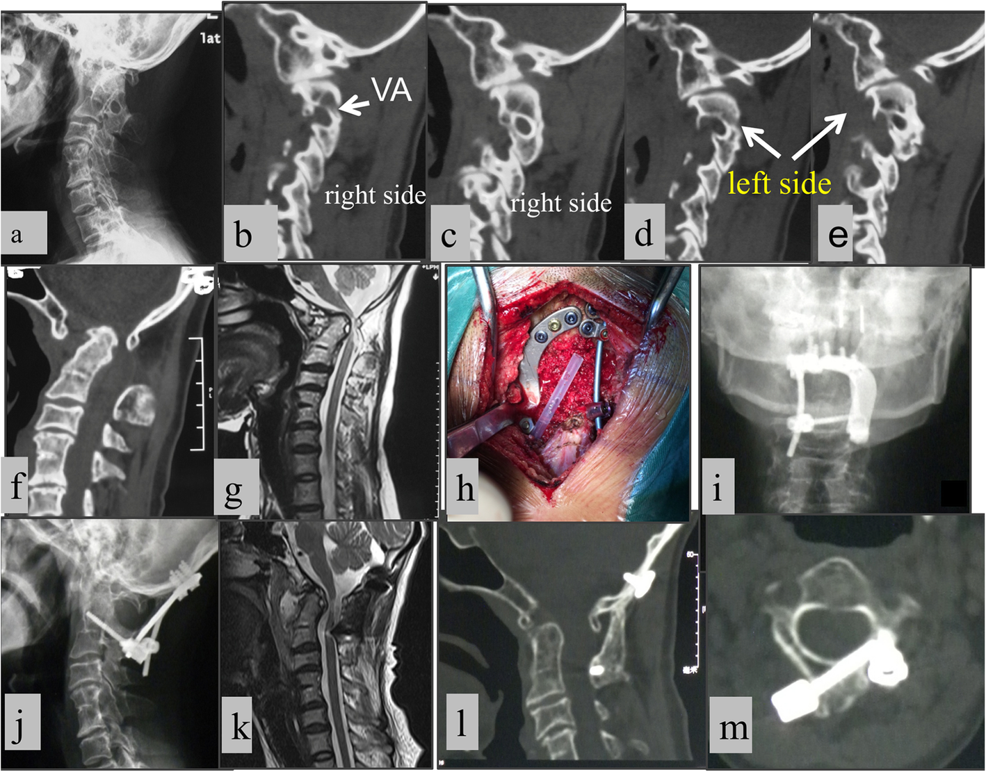 Fig. 6