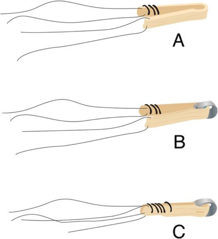 Fig. 2