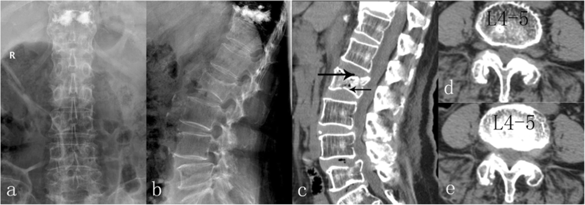 Fig. 5