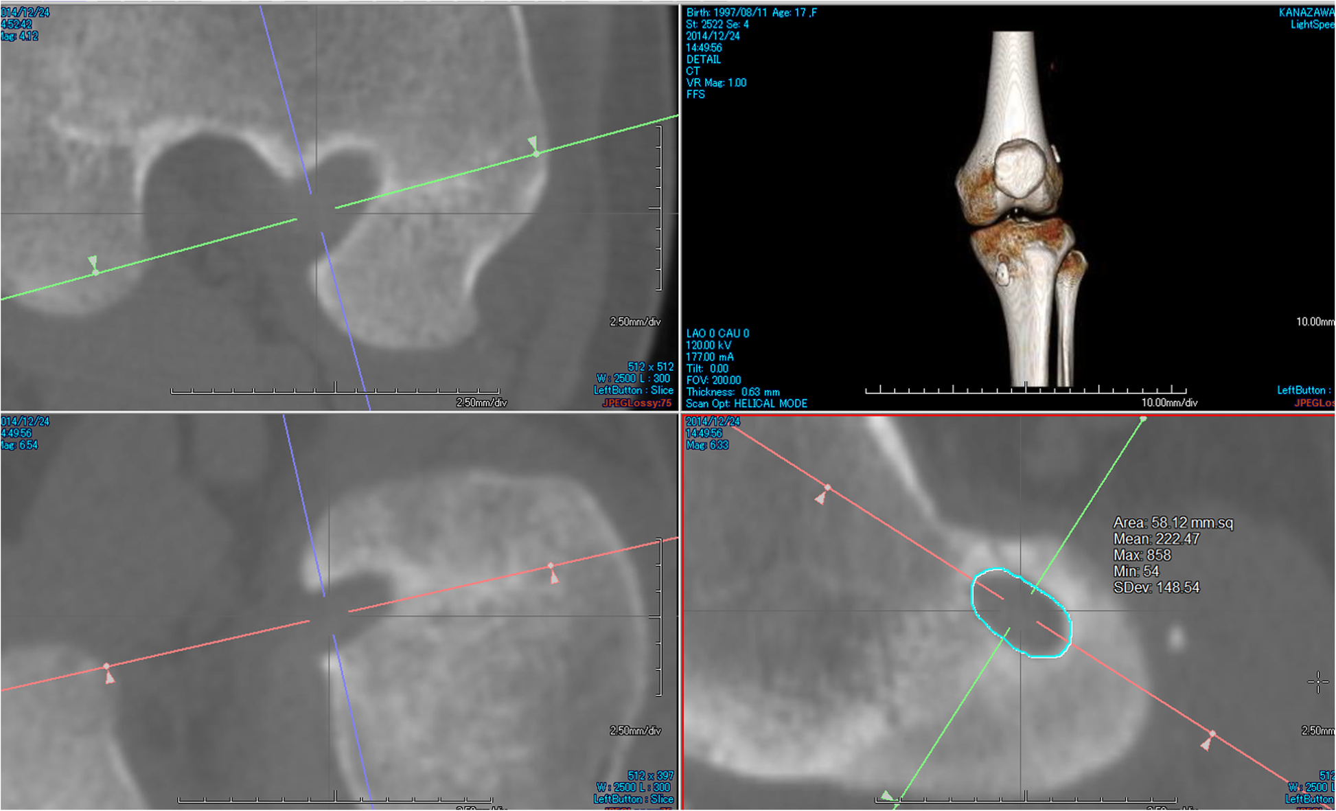 Fig. 3