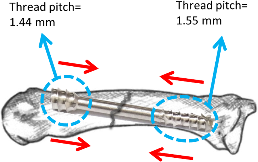 Fig. 2