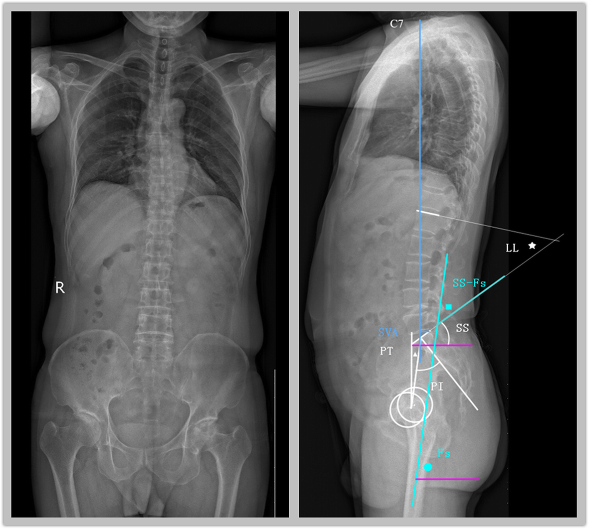 Fig. 1