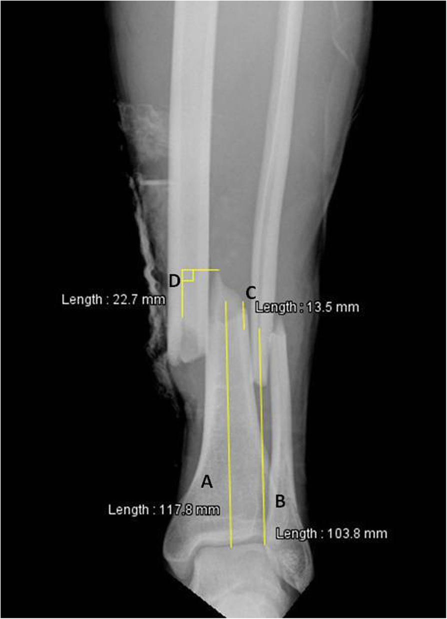 Fig. 2