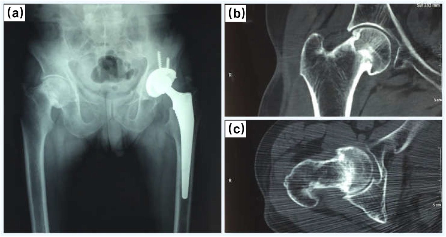 Fig. 6