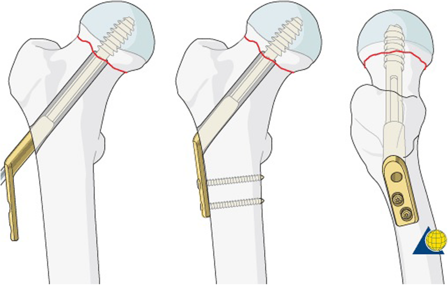 Fig. 1