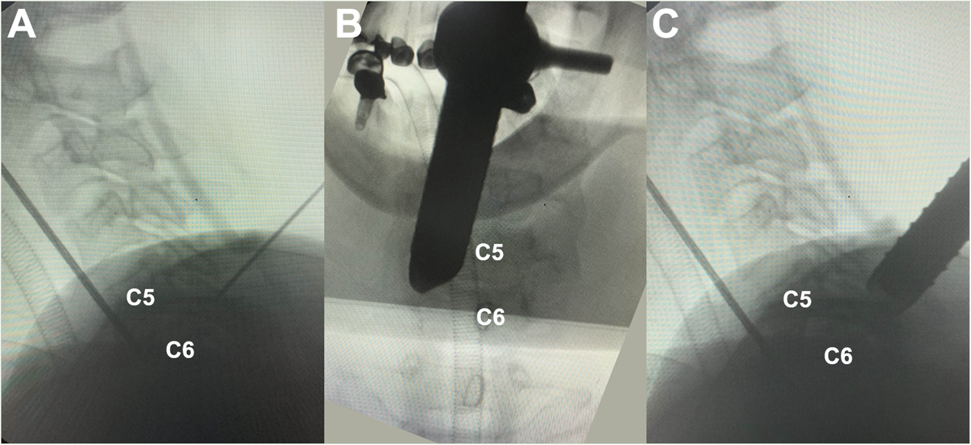 Fig. 4