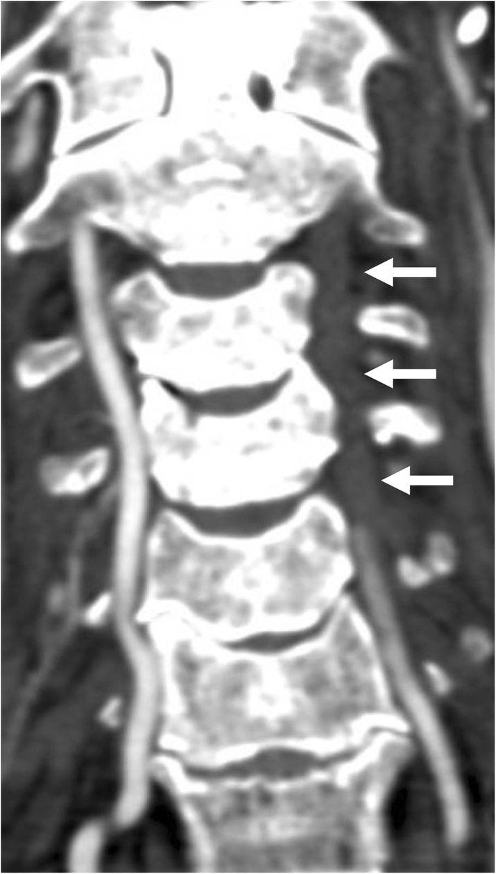 Fig. 6