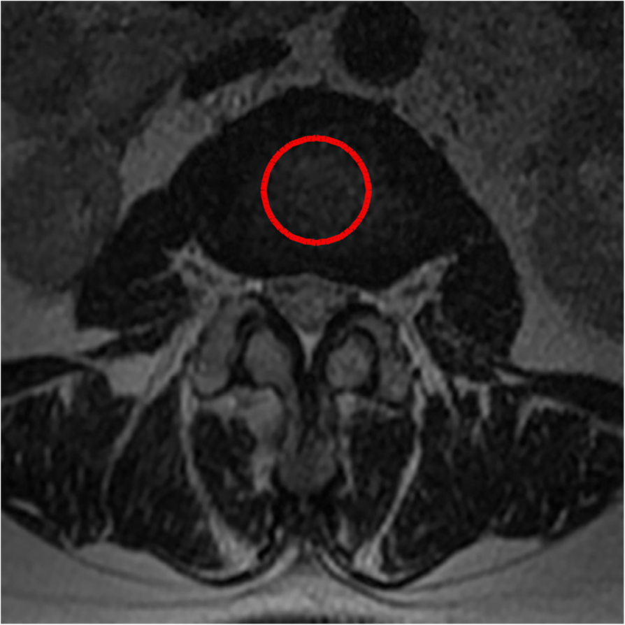 Fig. 11