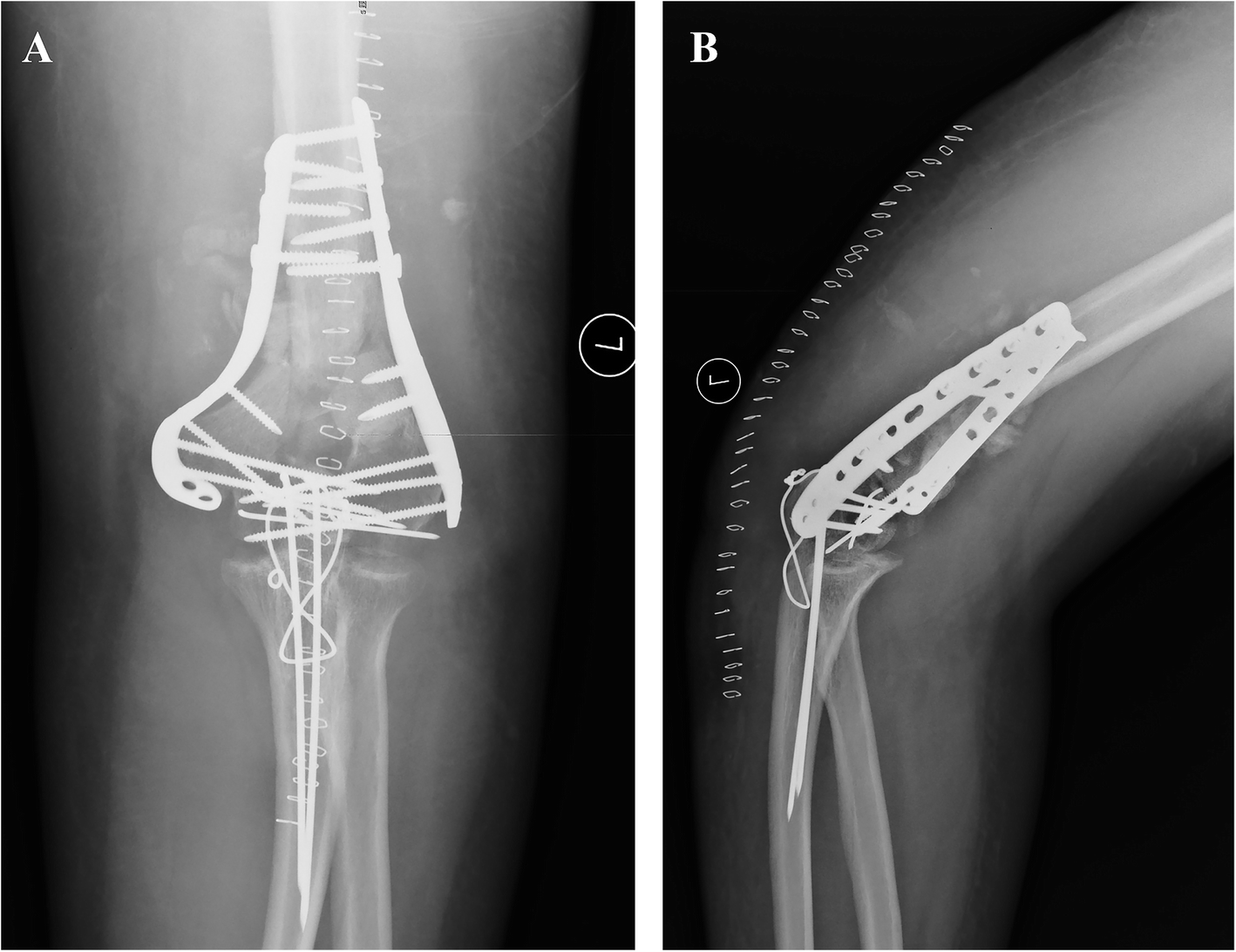 Fig. 4