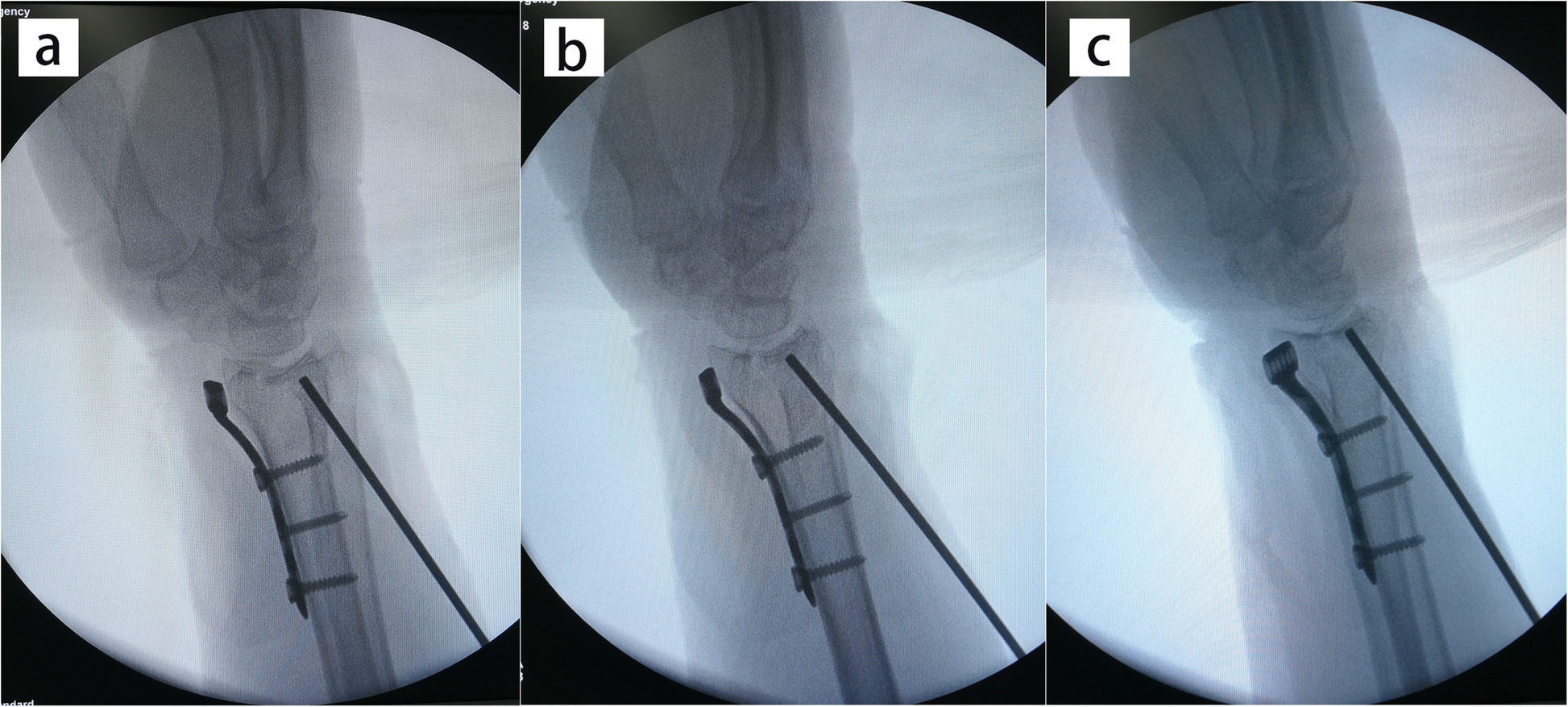 Fig. 4