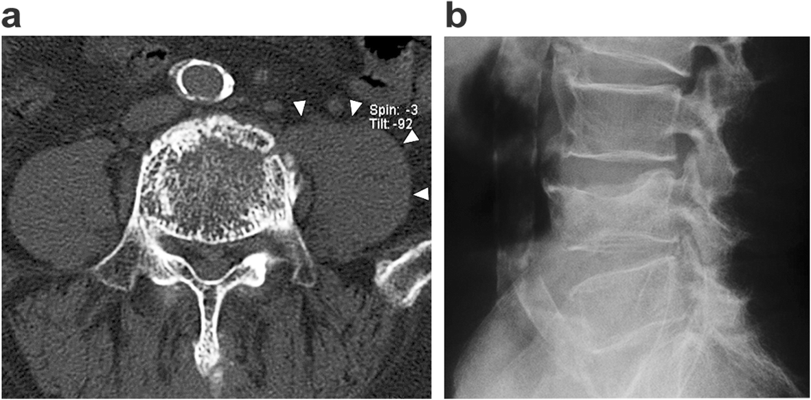 Fig. 6