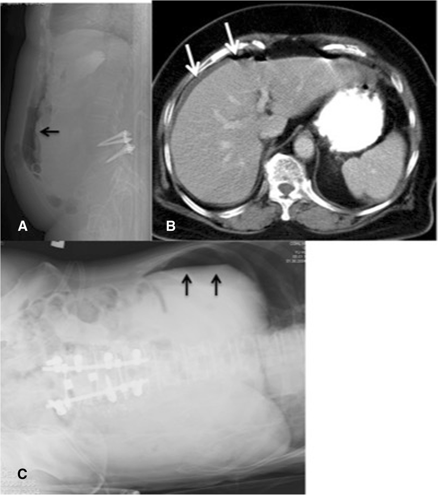 Fig. 1