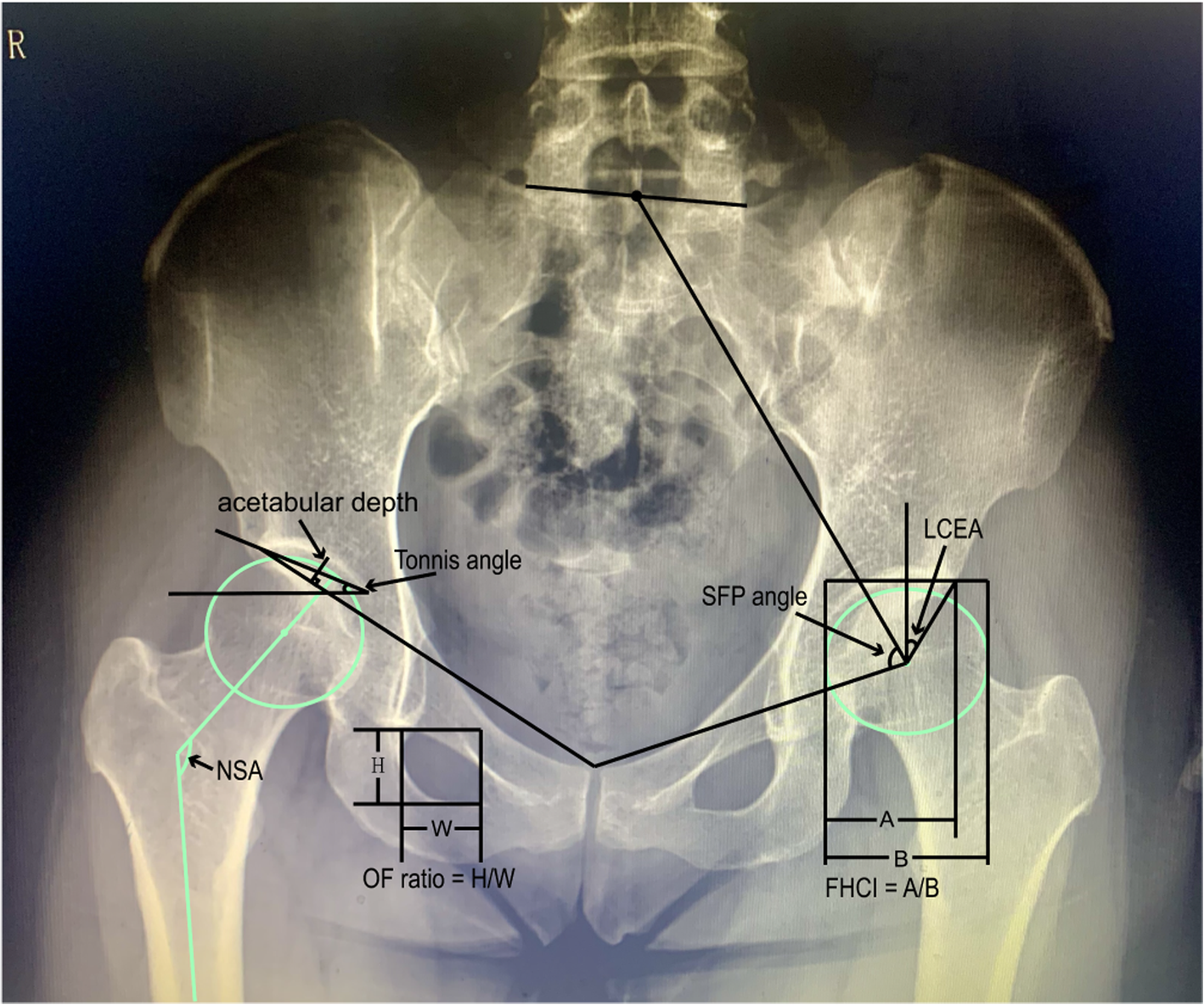 Fig. 1