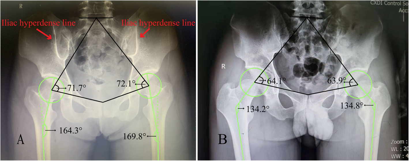 Fig. 3