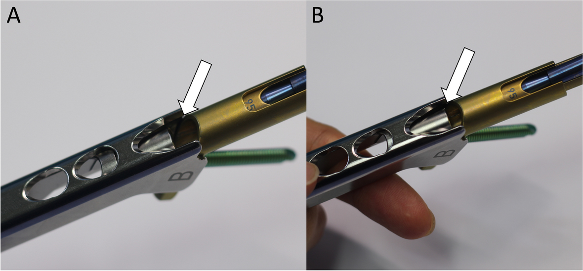 Fig. 10